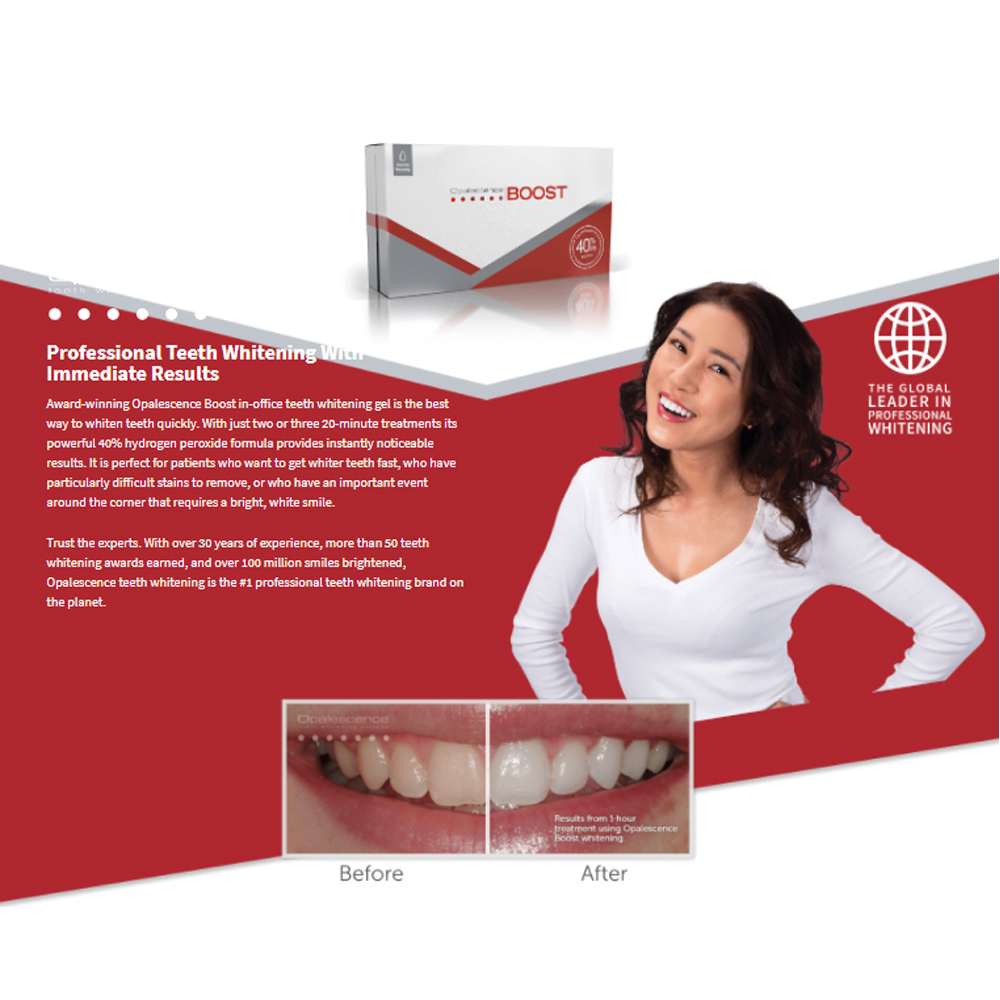 Opalescence Boost 40% PF Ameri - Teeth Whitening Gel Opalescence ulasan dan harga