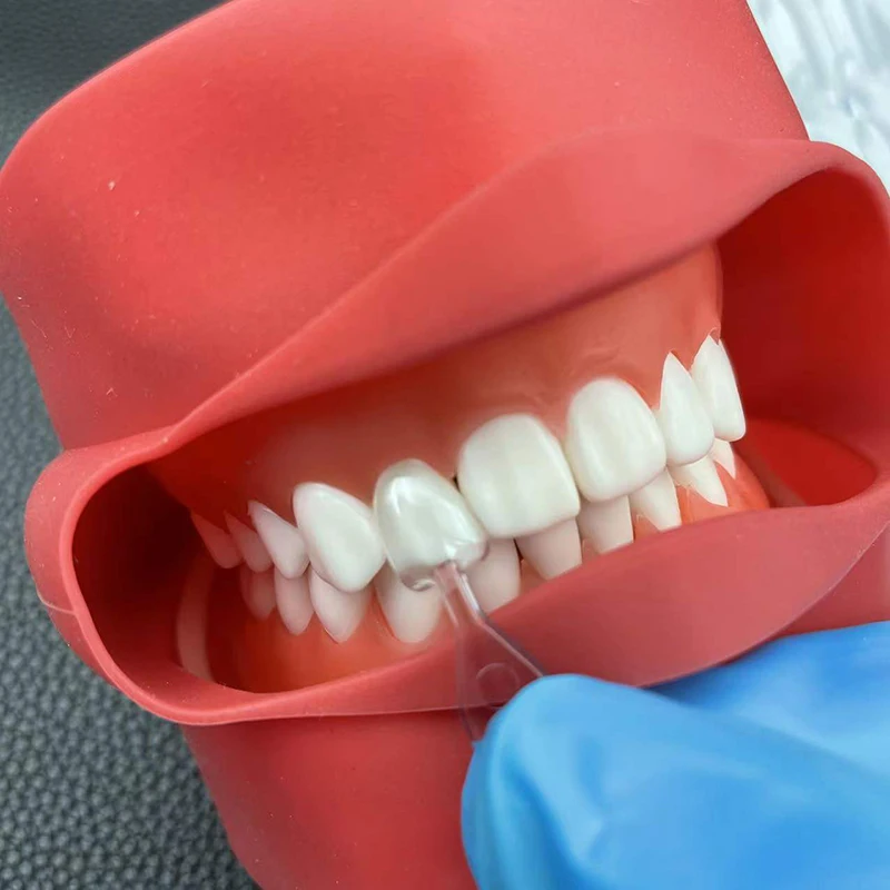 1Set/3Set/5Set Dental Veneer M - Teeth Whitening Moulds ulasan dan harga