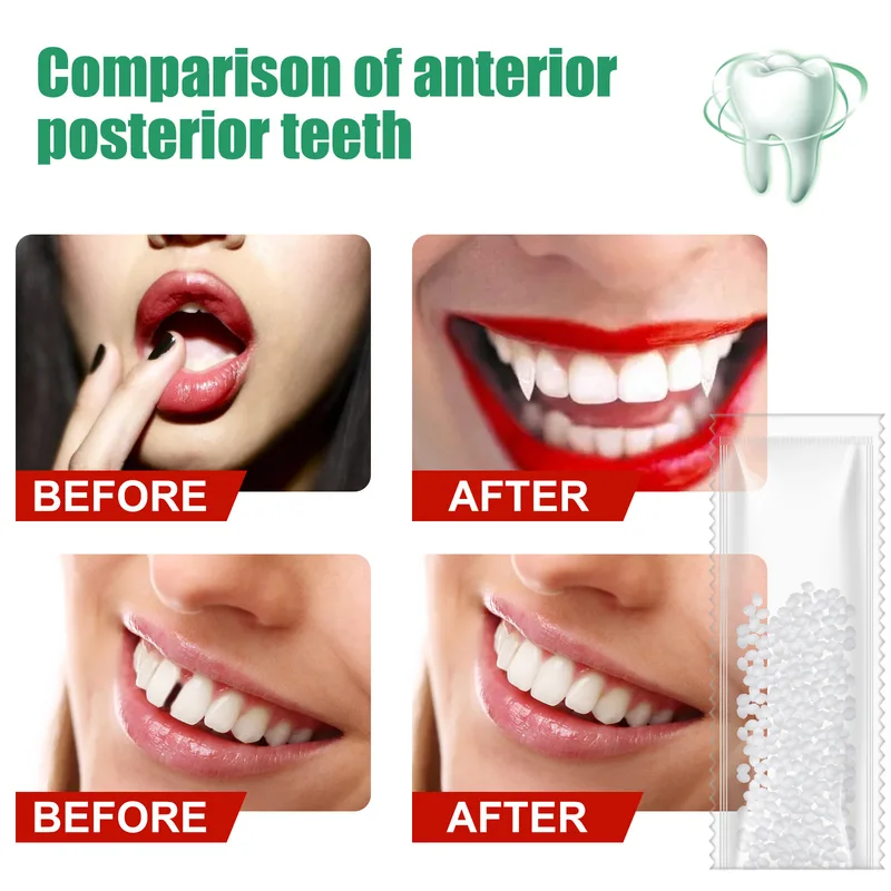 10g50g/30ml Resin Tooth Repair - Teeth Whitening At Home ulasan dan harga