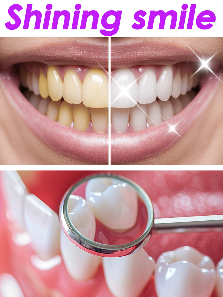 GlorySmile Teeth Whitening Fru - Teeth Whitening Xylitol ulasan dan harga