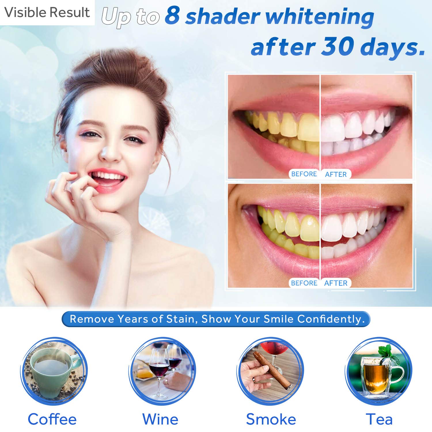 Teeth Whitening Gel Refill Syr - Teeth Whitening At Home ulasan dan harga
