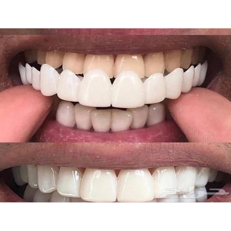 Soft Silicone Gel Dental Oral  - Teeth Whitening Moulds ulasan dan harga