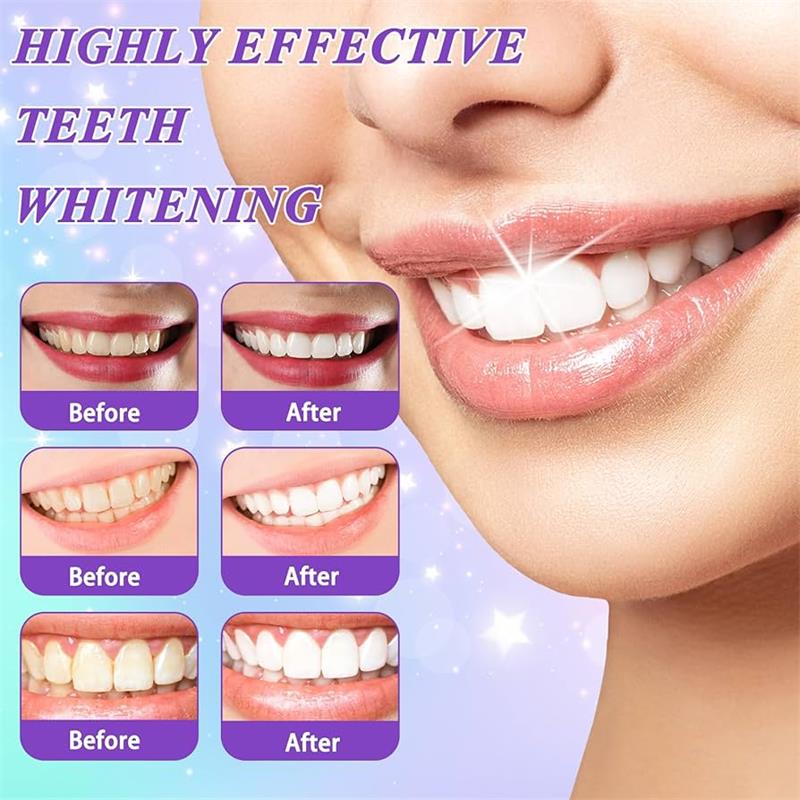 9D Purple Teeth Whitening Toot - Teeth Whitening Natural ulasan dan harga
