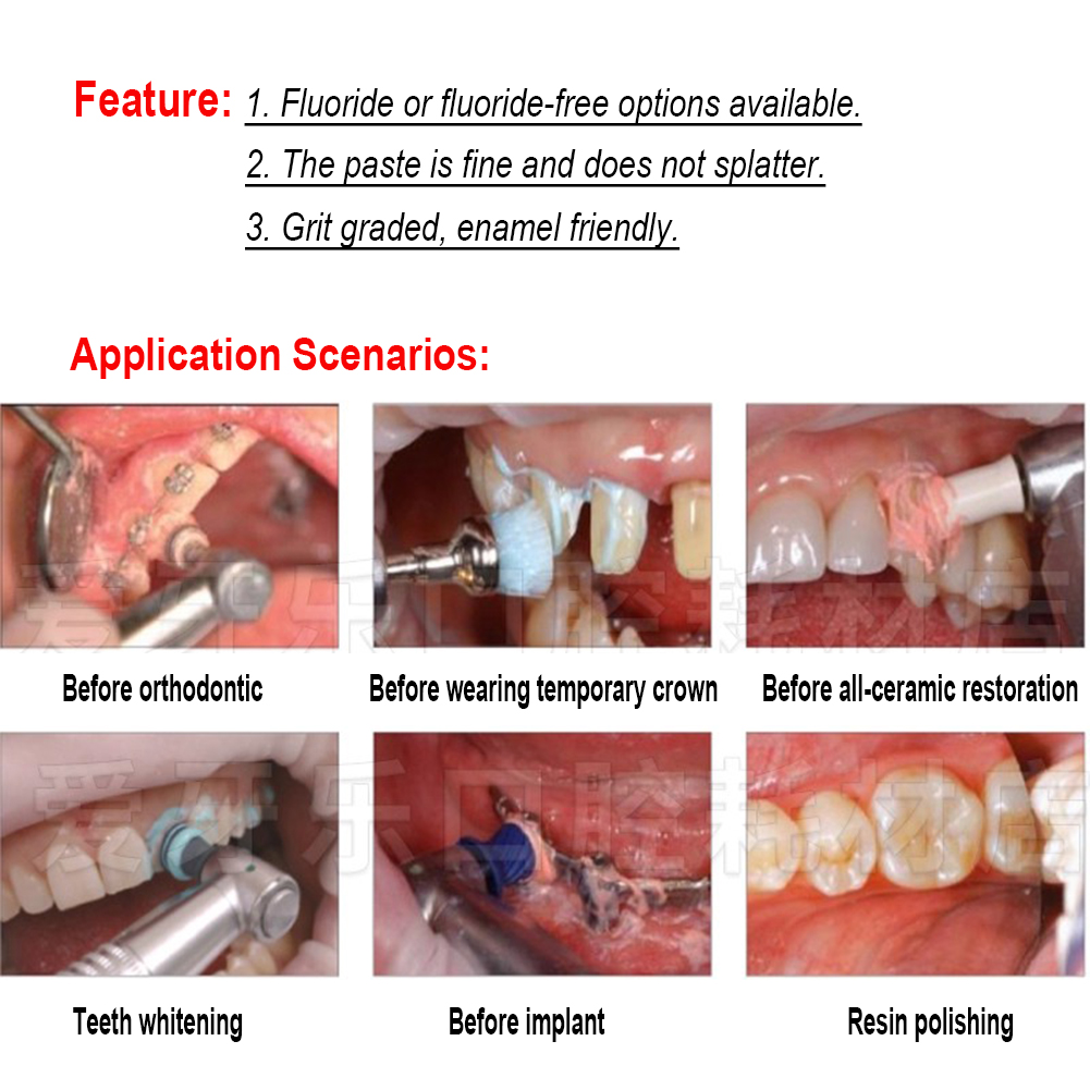 Ivoclar Vivadent Oral Teeth Po - Teeth Whitening Xylitol ulasan dan harga