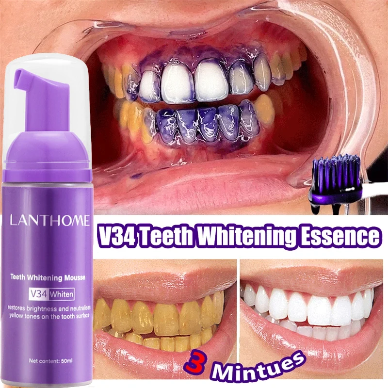 V34 Teeth Whitening Mousse Too - Teeth Whitening Xylitol ulasan dan harga