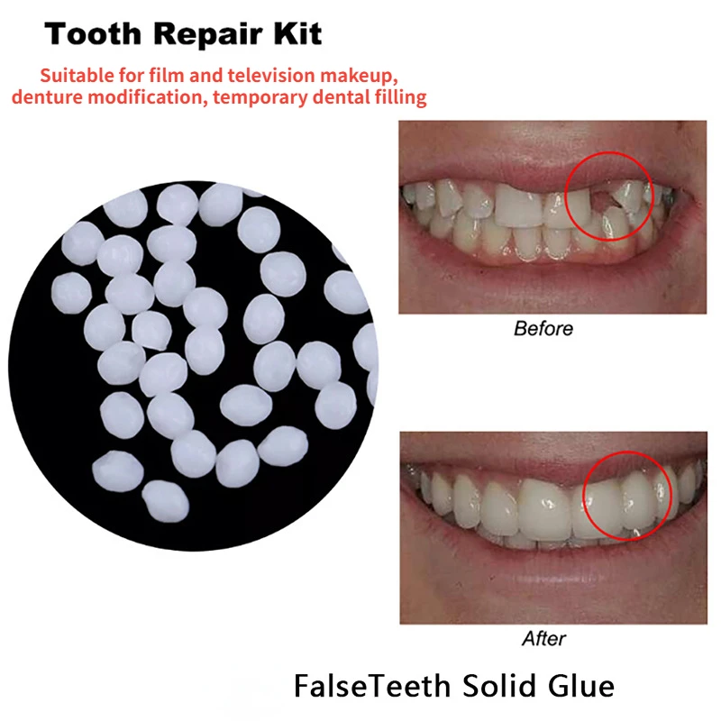 Tooth Repair Glue Shapeable Te - Teeth Whitening At Home ulasan dan harga