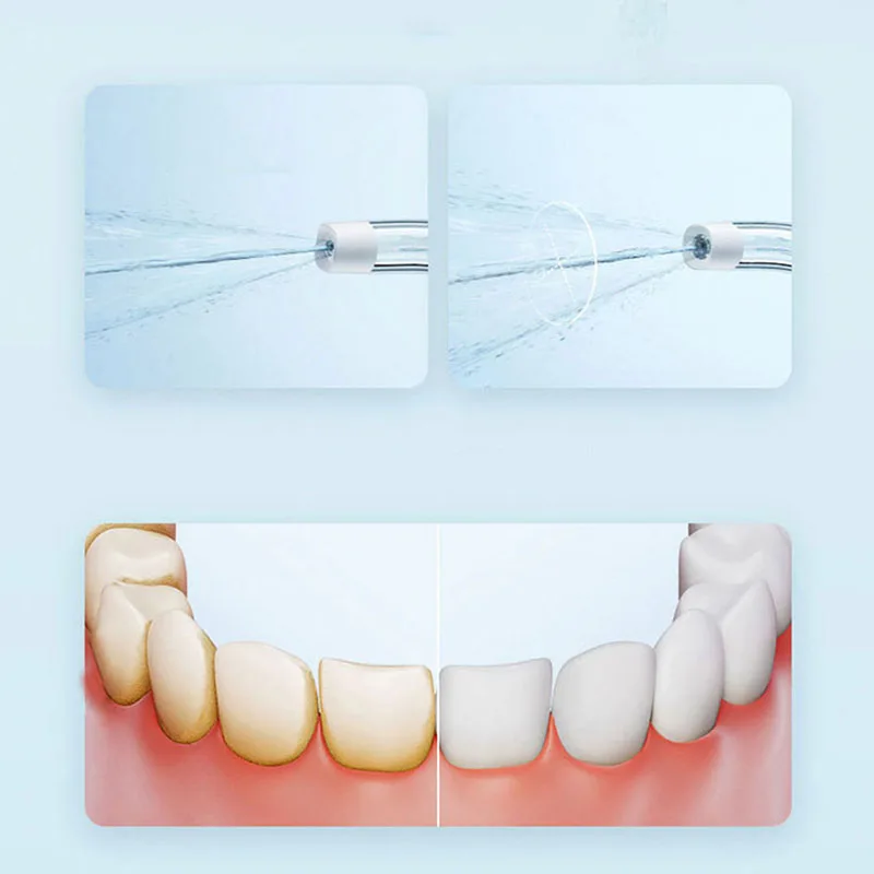 Xiaomi Portable Oral Irrigator - Teeth Whitening Quick ulasan dan harga