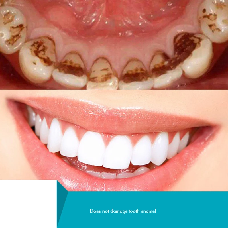 Herbal Tooth Powder, Natural T - Teeth Whitening Xylitol ulasan dan harga